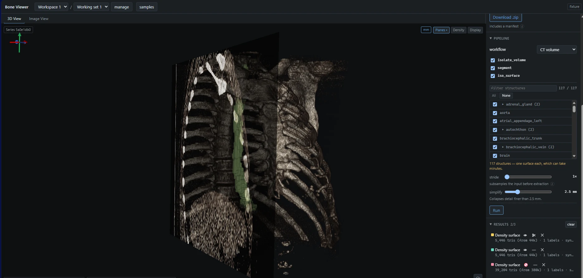 Bone Viewer 3D workspace with a segmented volume, structure list, and pipeline controls